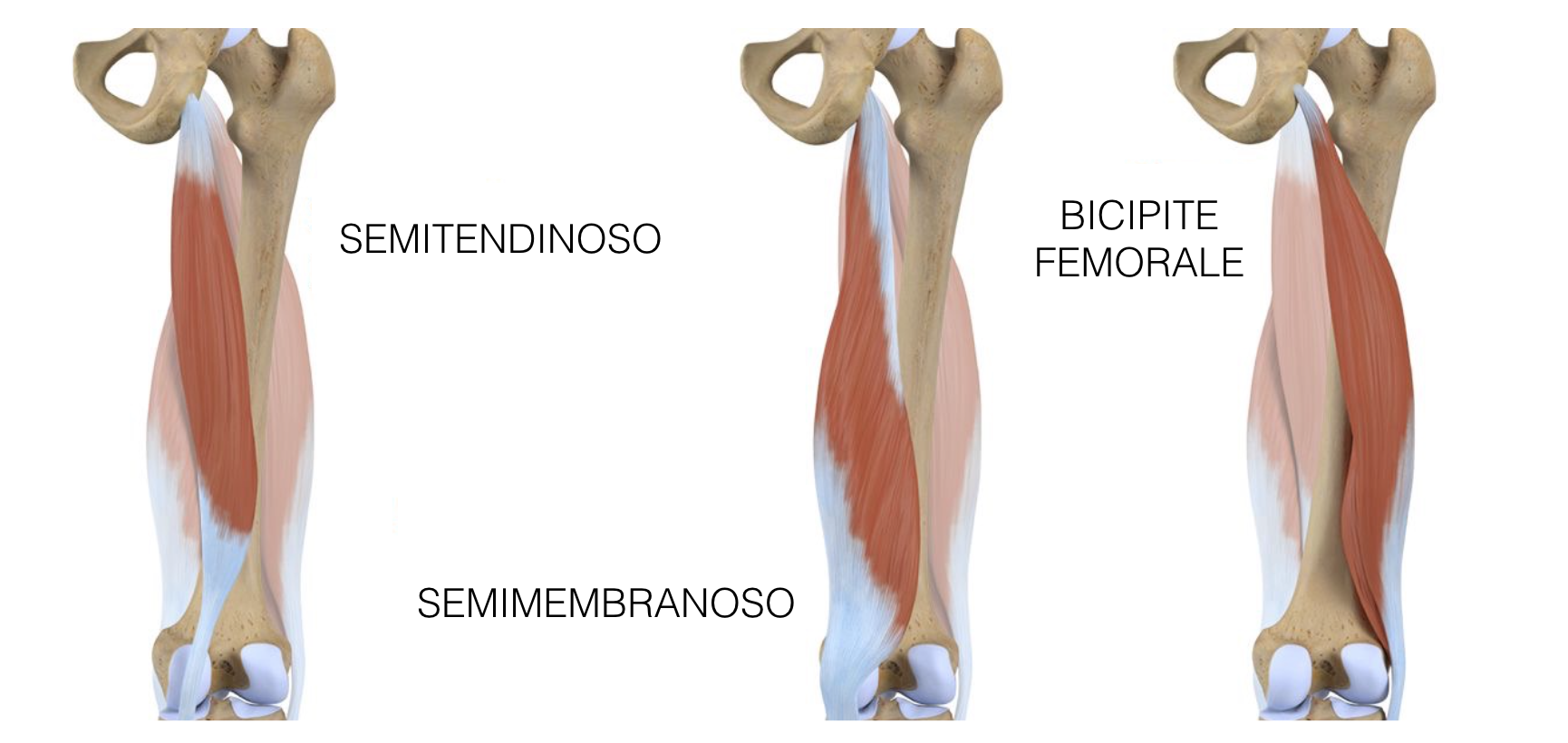 Tendine Bicipite Femorale Infiammato Sintomi